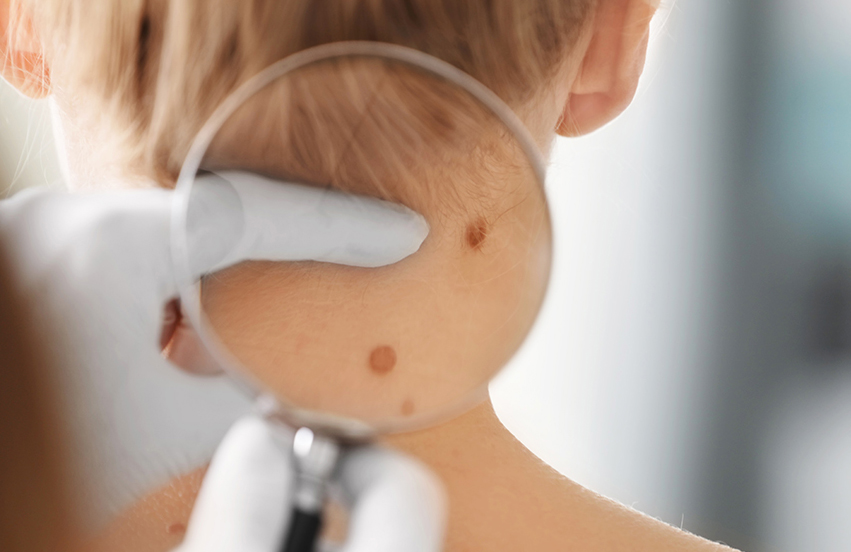 Olos Luce e le problematiche dermatologiche