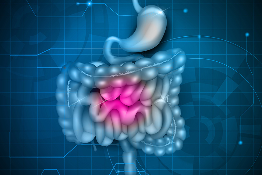 Metagenics e l’intestino irritabile
