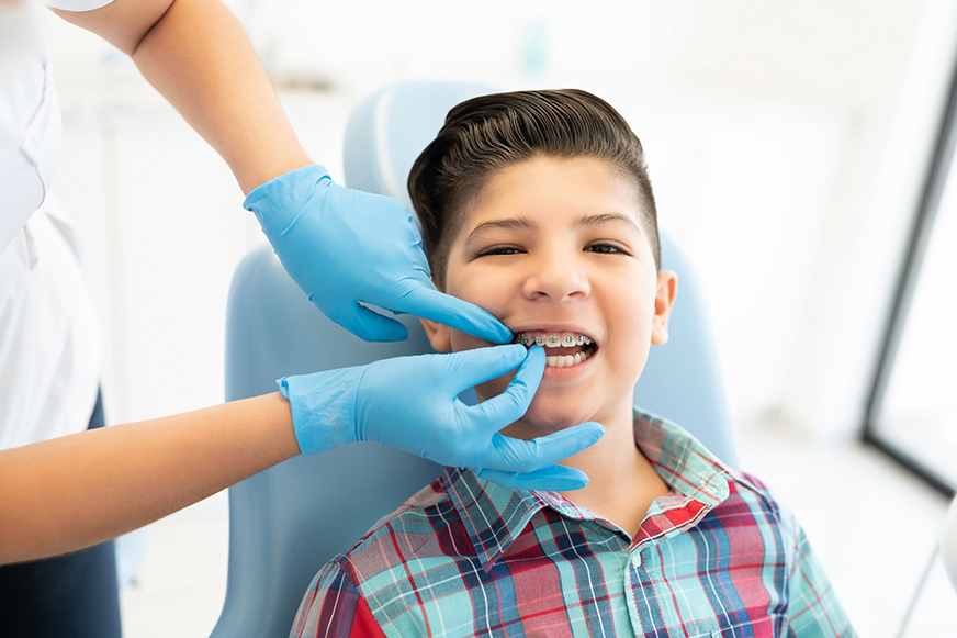 Denti storti, percezione di sé e bullismo: c’è una relazione?