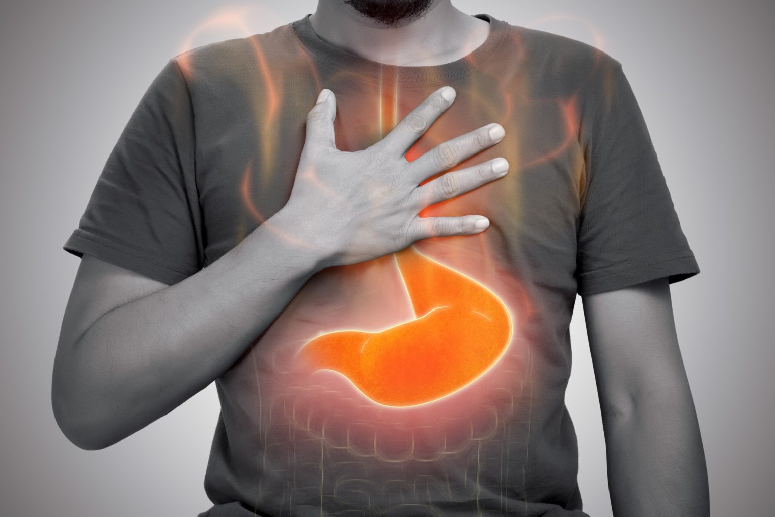 I danni degli inibitori di pompa protonica (“gastroprotettori”)