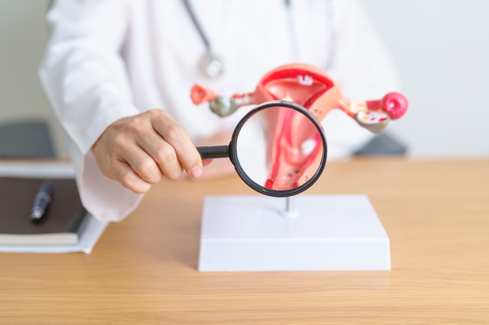 Endometriosi